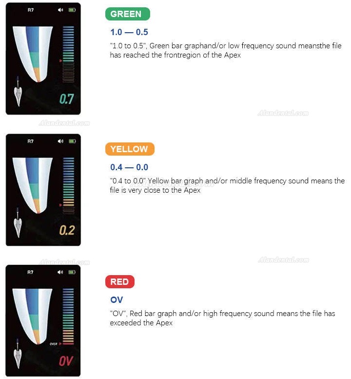 Dental Apex Locator R7 Mini Root Canal Measurement with Endo Ruler